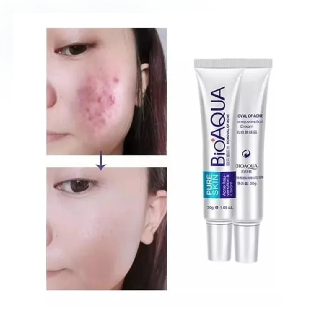 Crema Focal PURE SKIN Antiacne BIOAQUA