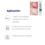 Crema Focal PURE SKIN Antiacne BIOAQUA