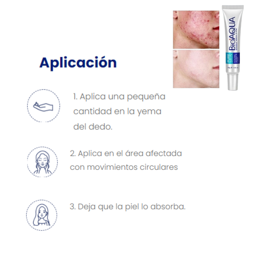Crema Focal PURE SKIN Antiacne BIOAQUA