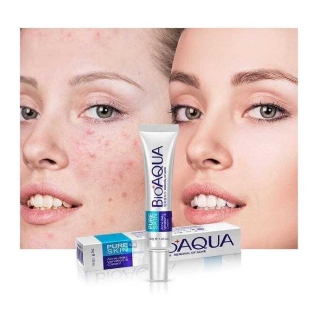 Crema Focal PURE SKIN Antiacne BIOAQUA